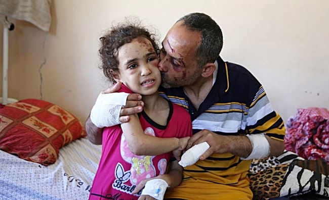 Suzy Ishkontana, 7 tahun, dicium ayahnya, Riad Ishkontana, 42, di Rumah Sakit Shifa di Kota Gaza, Selasa, 18 Mei 2021. (Foto: AP/Abdel Kareem Hana)