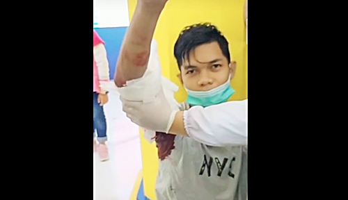Korban berlumuran darah setelah diserang ular phyton. (foto: tangkapan video)