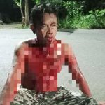 Ijun mengalami bermandikan darah usai meladeni tiga penyerang dirinya di Sungai Tabuk, Kalsel. (foto: sosmed)