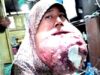 Norhayati, perempuan penderita tumor ganas sewaktu masih hidup. (foto: leon)