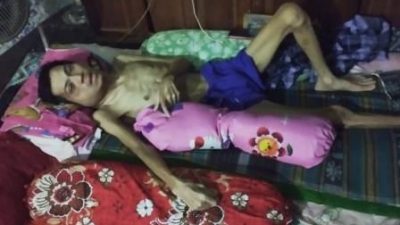 Memprihatinkan, Fathur Tergolek Menderita Kelenjar Getah Bening, Butuh Bantuan Segera
