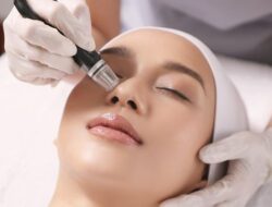 Poliklinik Kosmetik Medik RSD Idaman Kota Banjarbaru Dilengkapi Alat Pico Laser